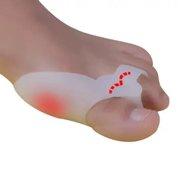 2 ЕЛЕМЕНТА Силиконови Бурсит на Палеца на Стъпалото Коректор Ортопедични Изправяне на Сепаратор за Облекчаване на Болката